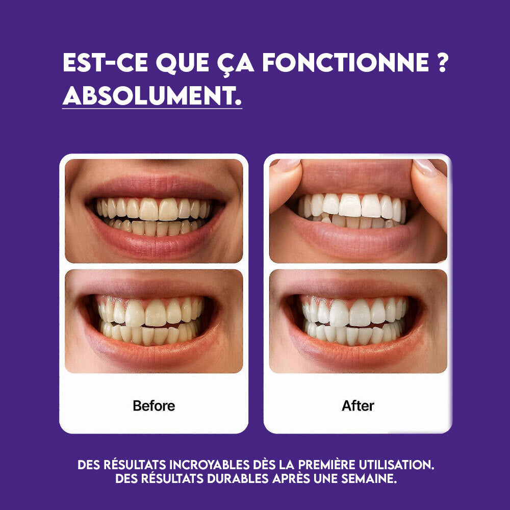 Pack DrDent - 42 Bandes blanchissantes violettes